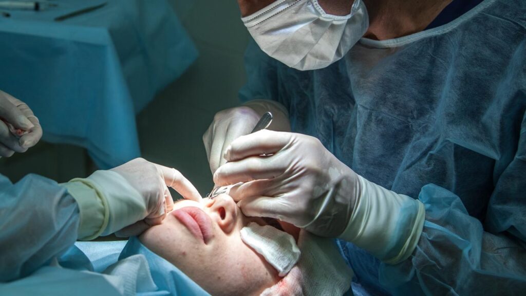 Pengertian Operasi Plastik